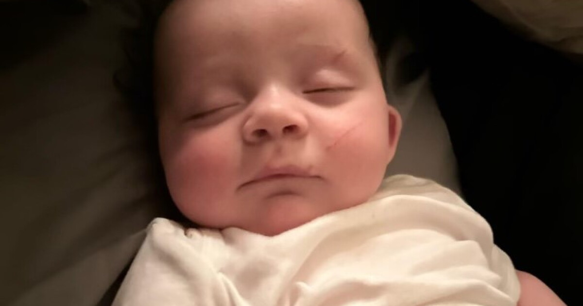 'Placed in a tree': Baby found injured in debris following tornado - Vimarsana News