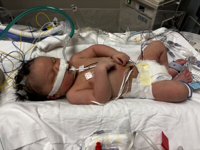 Ziggy Quarles hospitalized after having difficulty breathing at birth