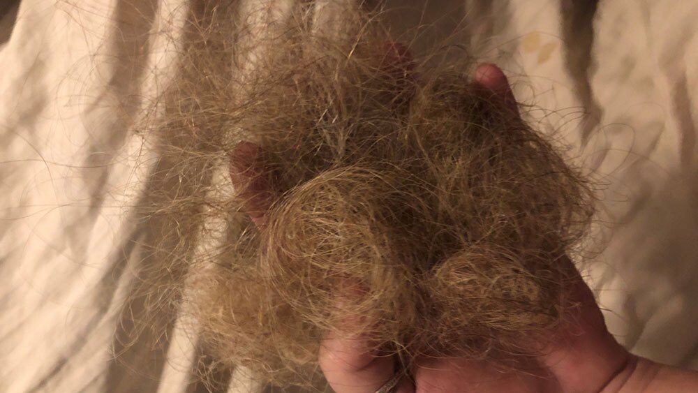 Monat-Global-product-hair-loss-Pam-Benson.jpg
