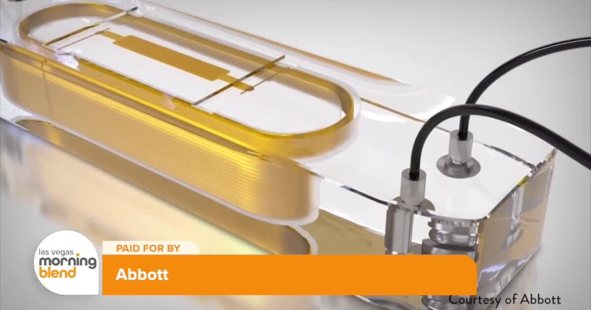 Abbott Rpp Machine New Device Helps Heart Failure Patients Live Fuller Lives