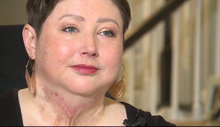 Liz Burn Recovery 01.png