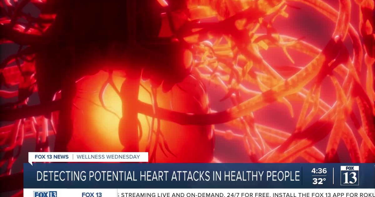 Preventative Heart Scan A simple scan can help detect heart disease in healthy people