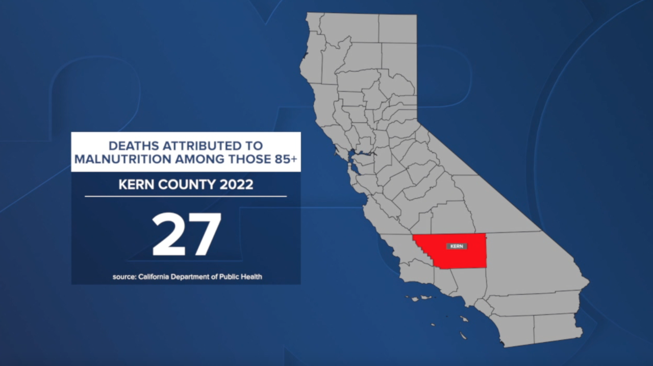 Kern County deaths attributed to malnutrition