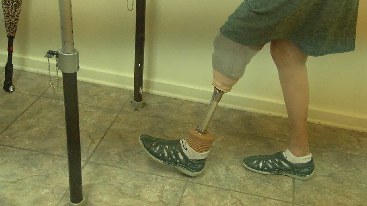 Microprocessor Foot Local Woman is 1 of 15 to get Microprocessor Foot and Ankle
