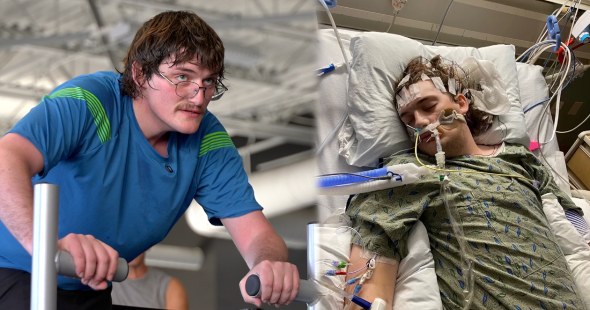 A massive stroke changed his life. But it didn't stop his journey to become a nurse.