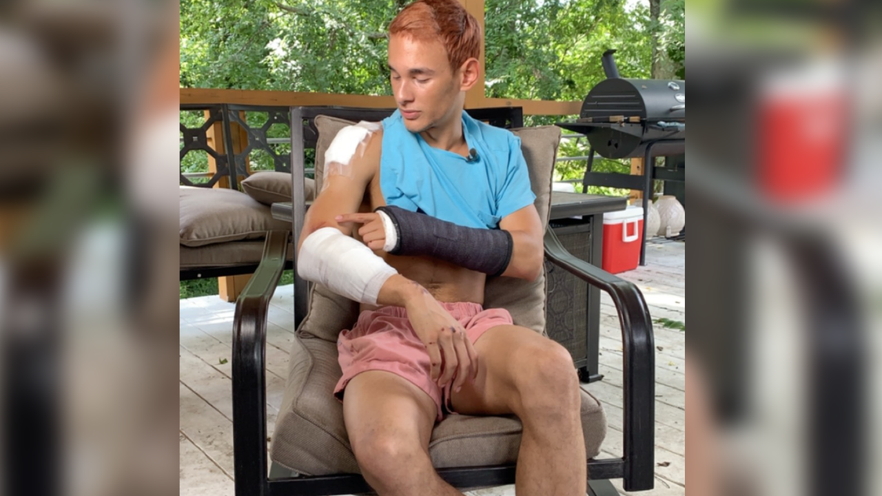 Scooter Crash 2