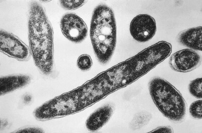 Legionnaires Disease