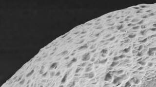 A picture from MIT of the encapsulating material that "cloaks" insulin-producing cells.