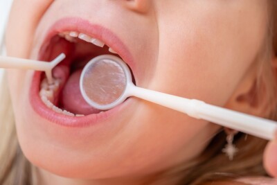 Dentist,,Doctor,Examines,Oral,Cavity,Of,Small,Patient,,Uses,Mouth