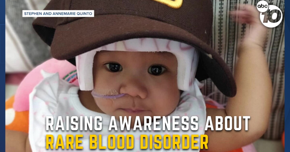 San Diego family hopes to raise awareness about rare hereditary blood condition - Vimarsana News