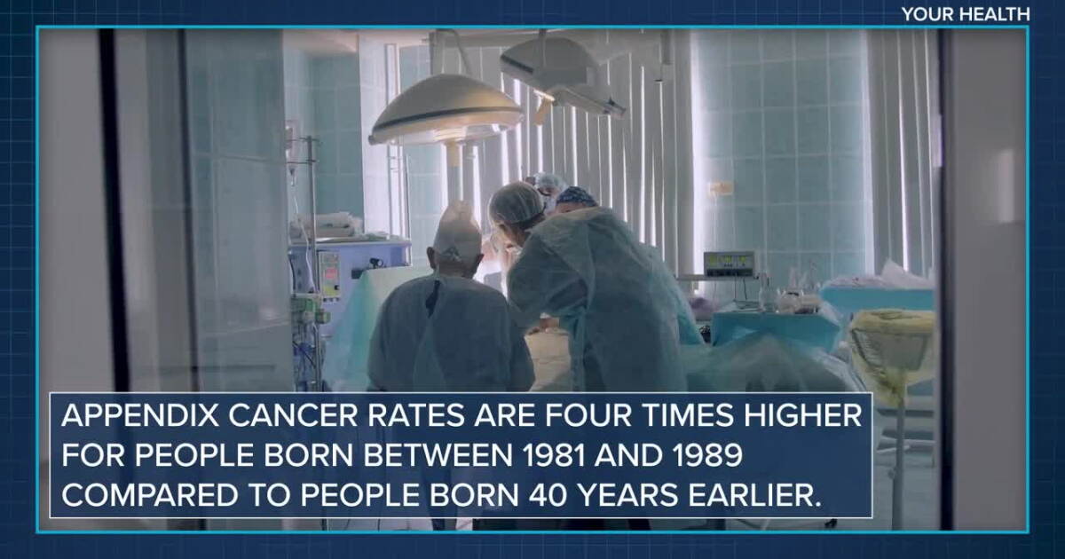 Appendix Alcer New study shows an increase in cases of appendix cancer in some age groups