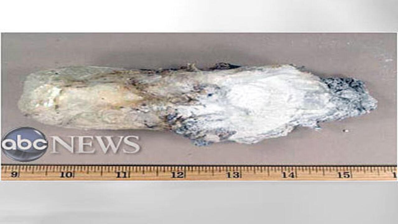 'Underwear Bomber' sues over prison treatment