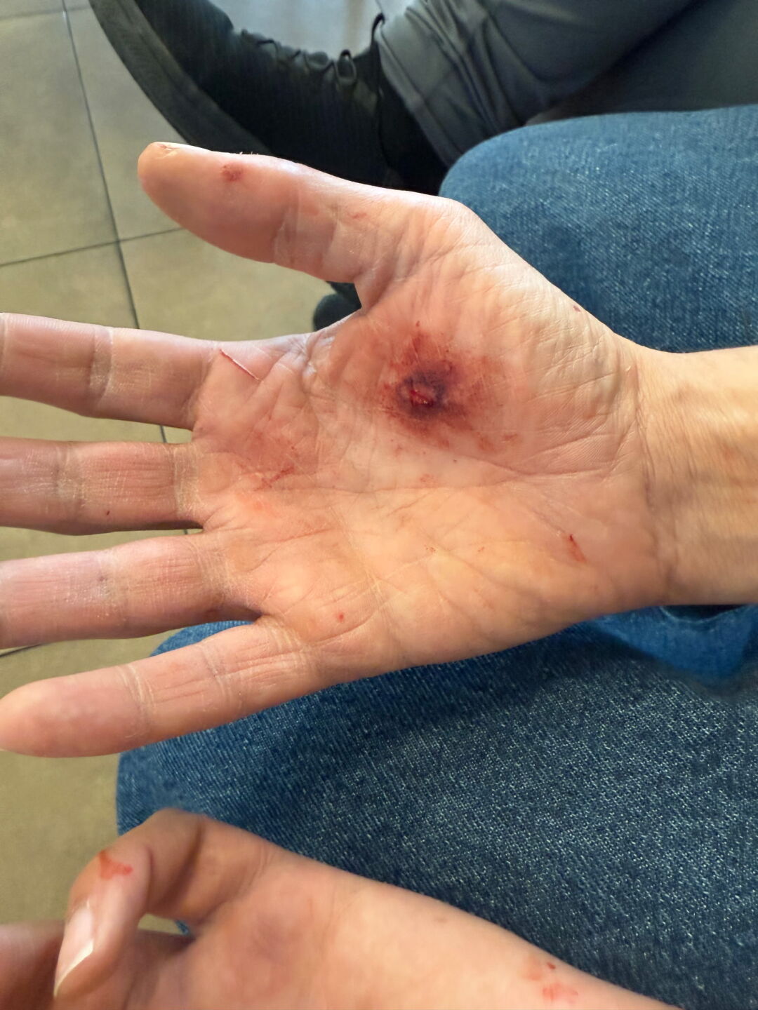 Boardmoor injured employee