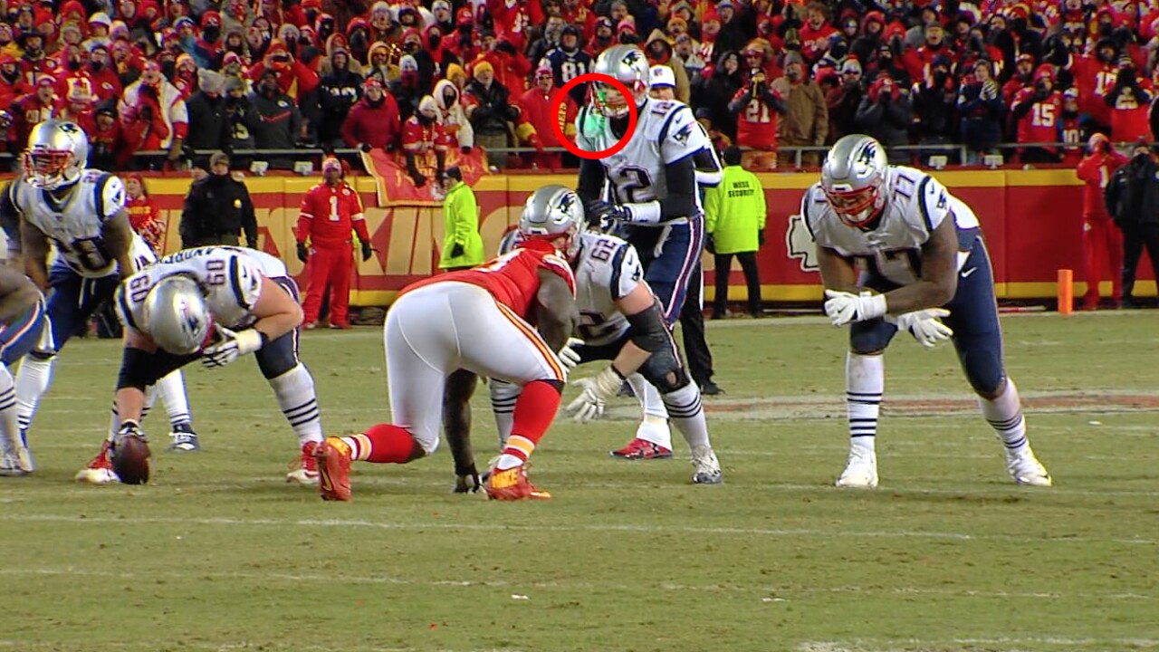 Video appears to show laser pointed at Tom Brady during AFC Championship