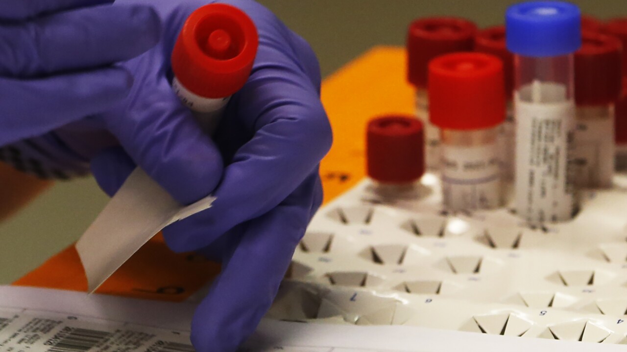 Sonora Quest Labs Announces Increase In Covid 19 Antibody Testing