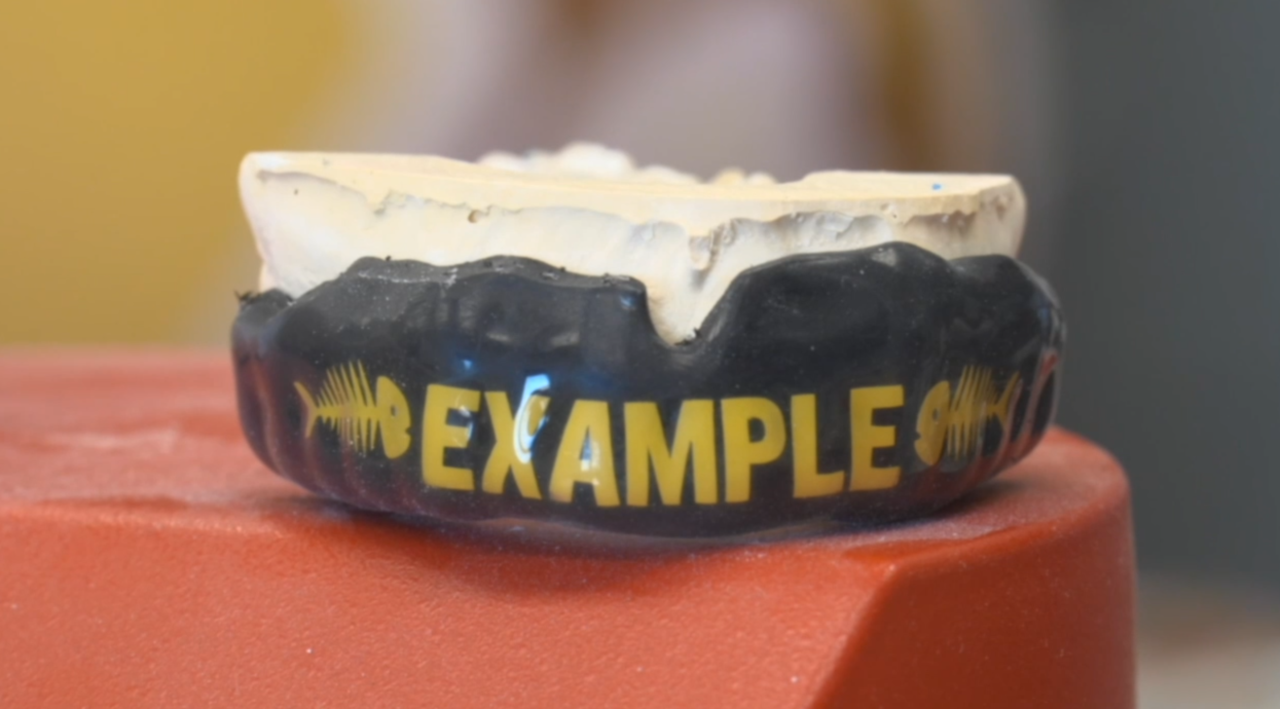 Las Vegas artist makes custom mouthguards for boxing's biggest names