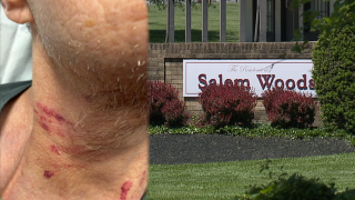 'They failed him' | Woman says husband was attacked at Anderson Twp. nursing home, claims staff was negligent