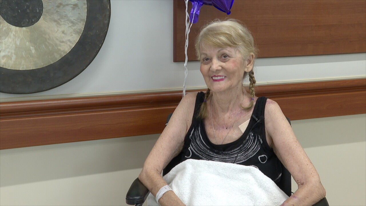 Betty-Lou Summer recovers from burn incident