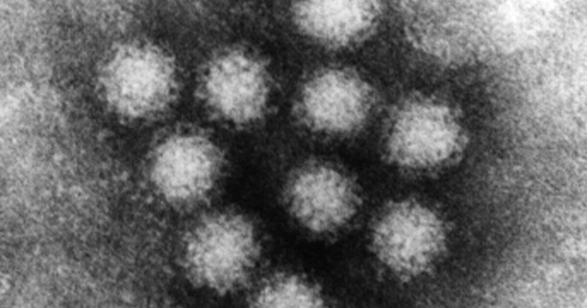Ask Dr. Nandi: The symptoms of norovirus and how to prevent its spread - Vimarsana News