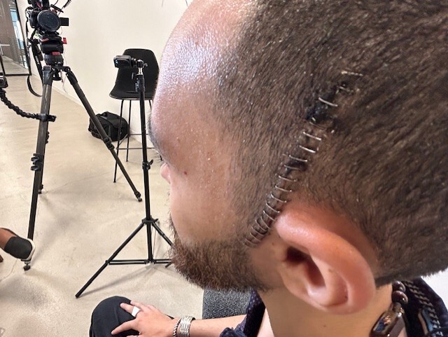 Alejandro Gabriel Claure de la Zerda injuries