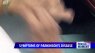 Symptoms of Parkinson's disease