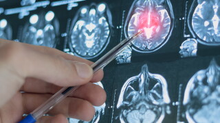 Ct,Scan,Image,Of,Human,Brain.,Mri,Or,X-ray,Scan