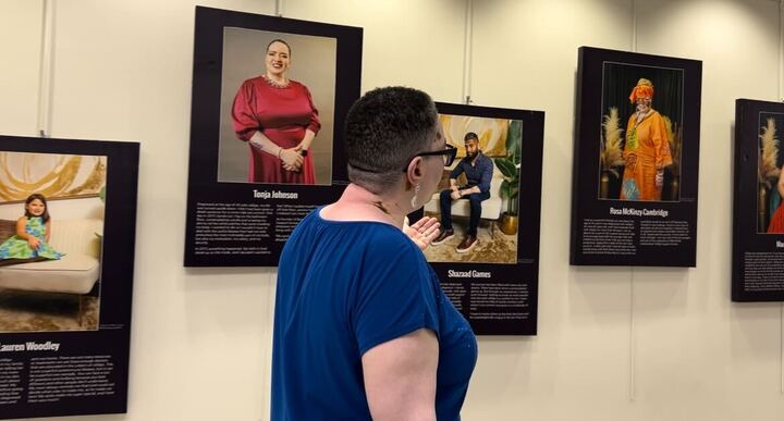 How one woman is spreading awareness about vitiligo through a traveling exhibit