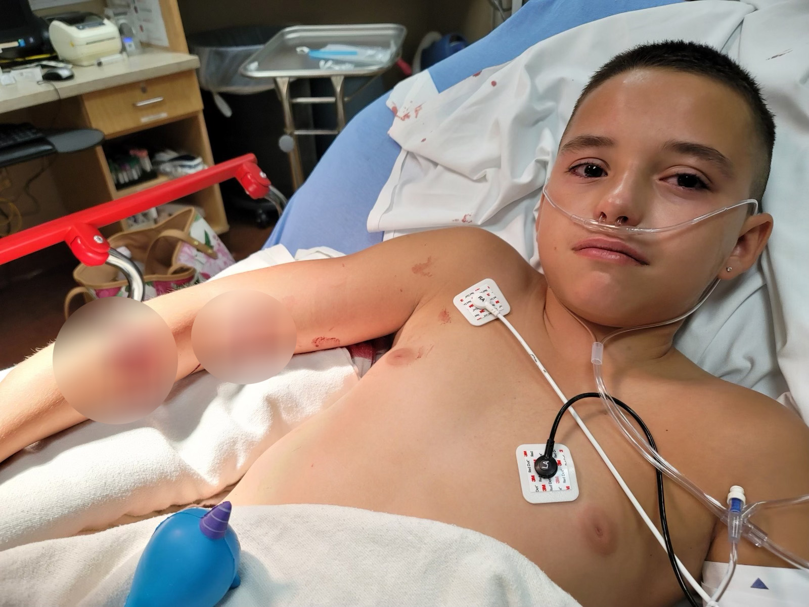 injured boy in shooting aug 22 2022 outside denver school