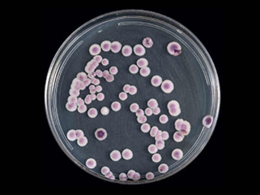 Fungal infection in local hospitals raises concerns for families and medical experts