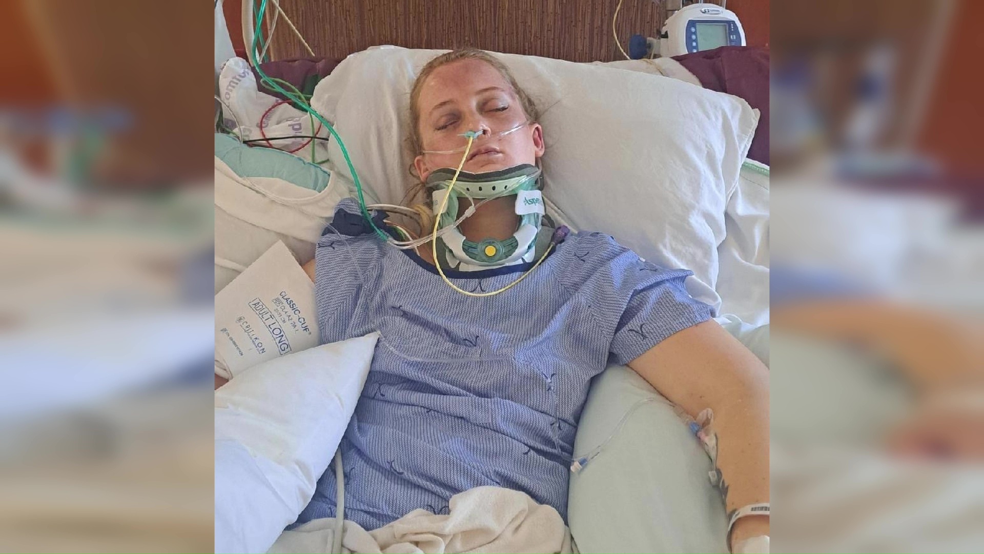 Woman recovering after leg amputation following crash Kealy Milton