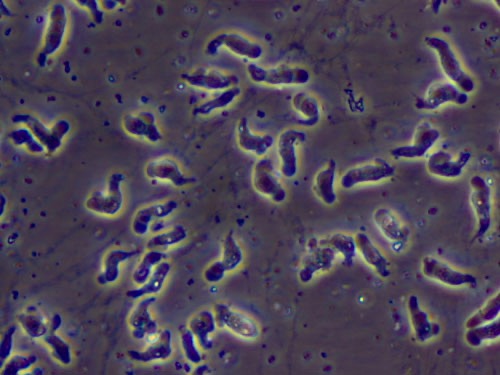 AMOEBA.jpg
