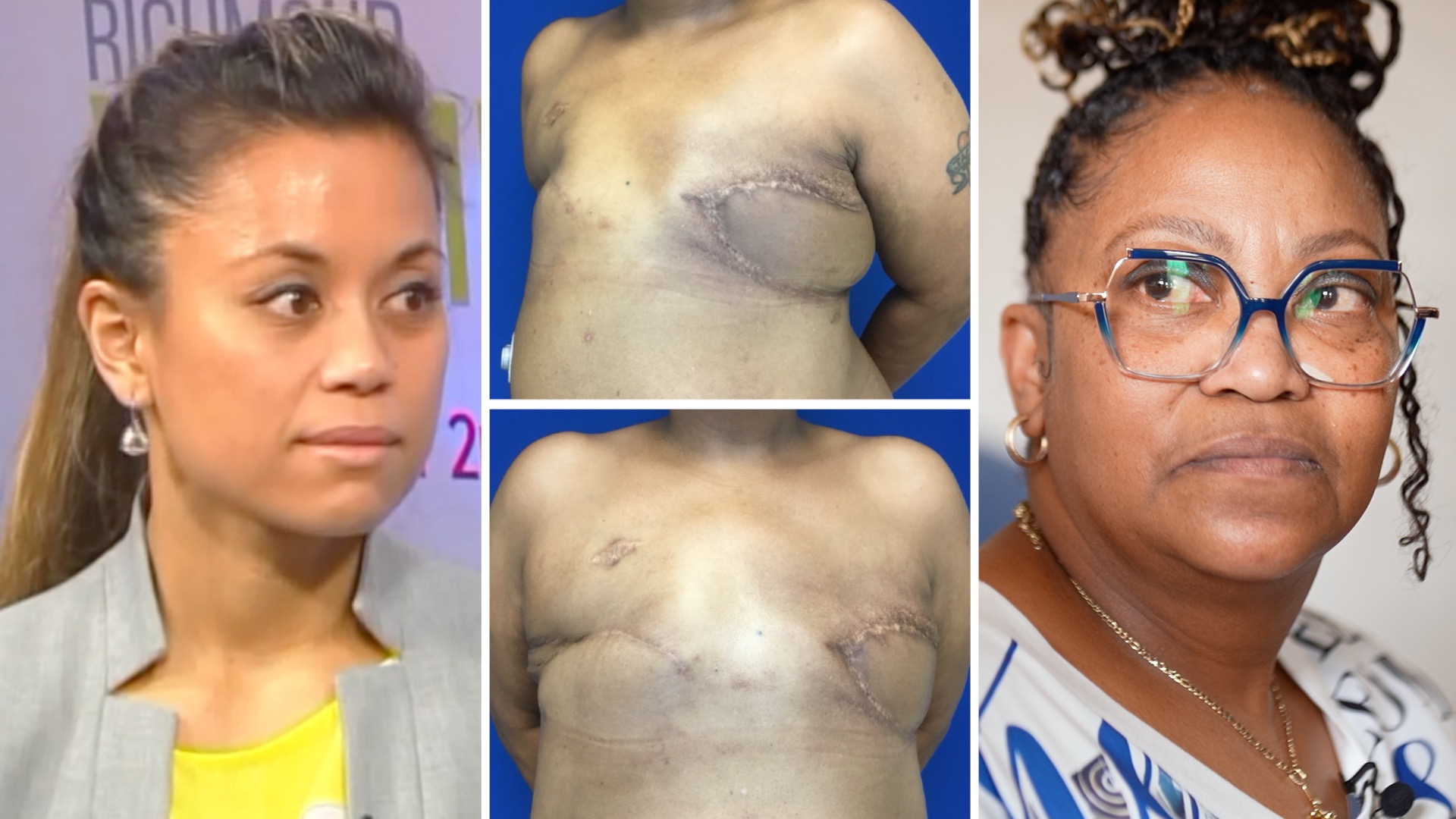 Angela Oliver and images of her post surgery.