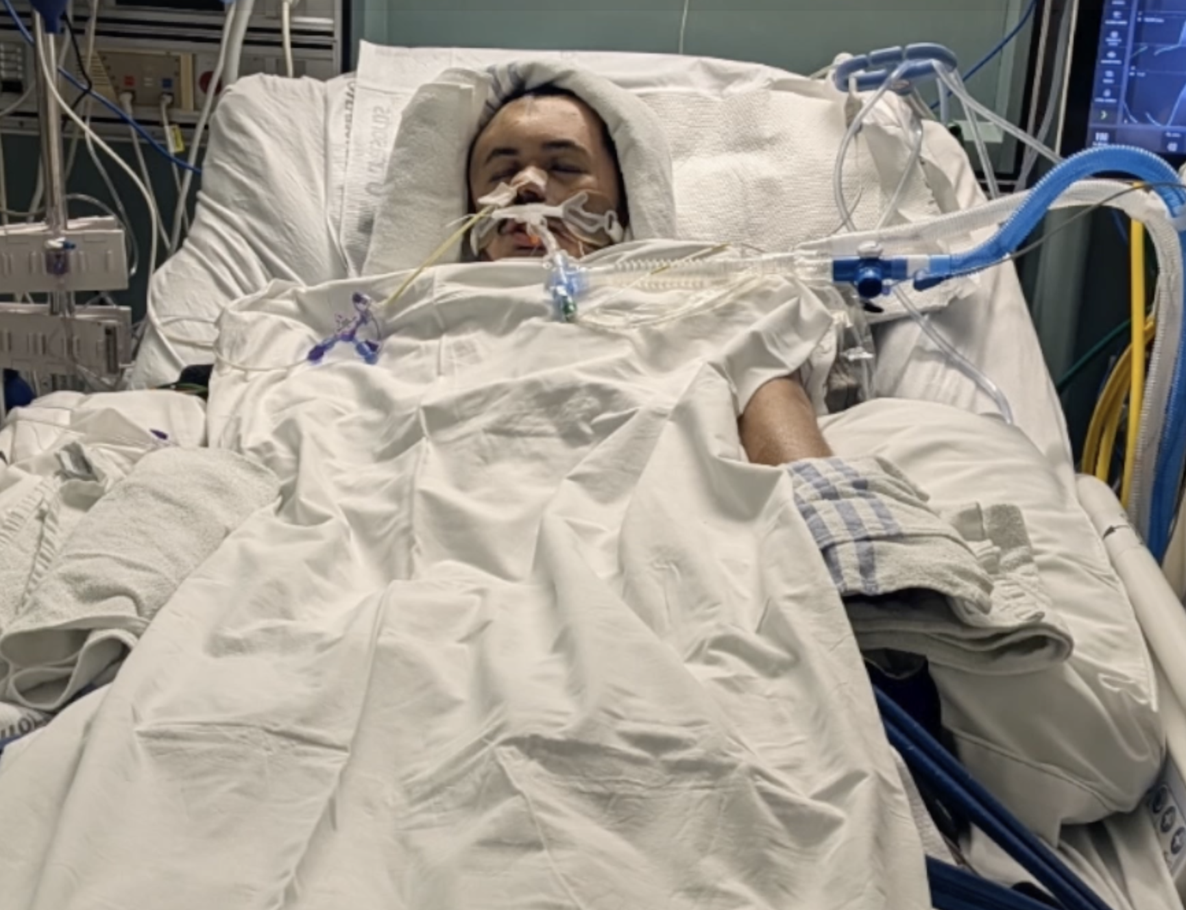 City Heights man brutally attacked by 'known transient', left with severe brain damage