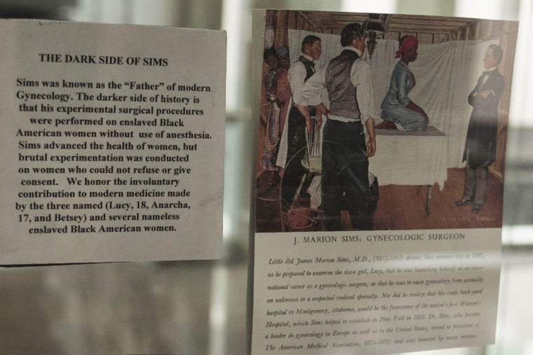 Photo of enslaved woman during medical experiment in 1840's
