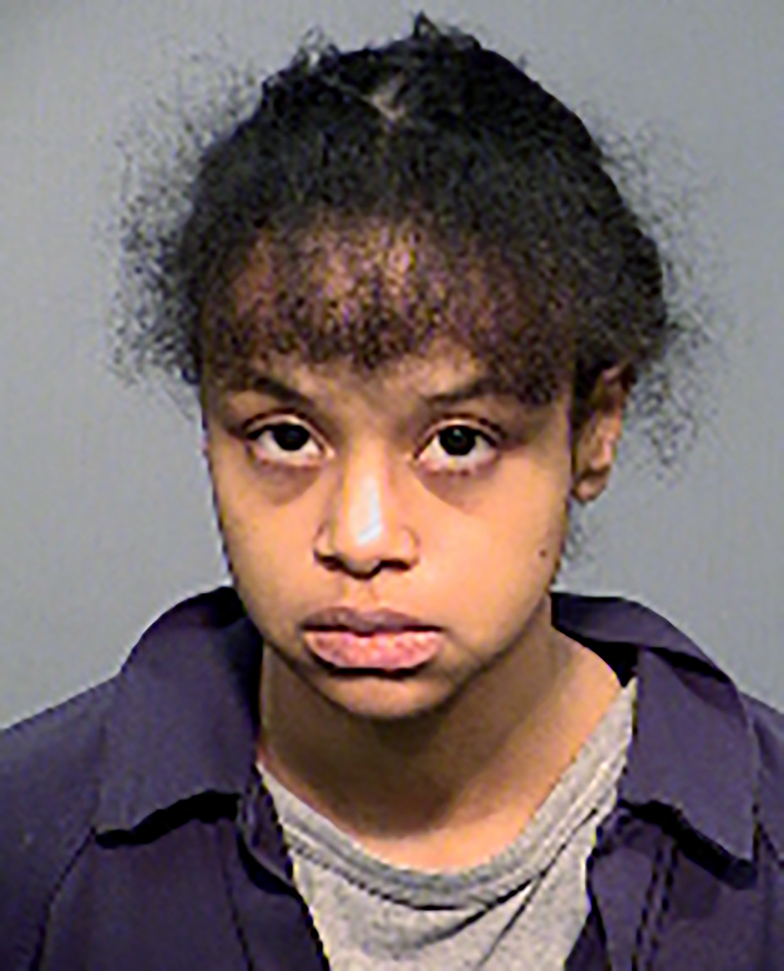 Malnourished Child Dies