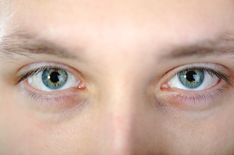 Eyes