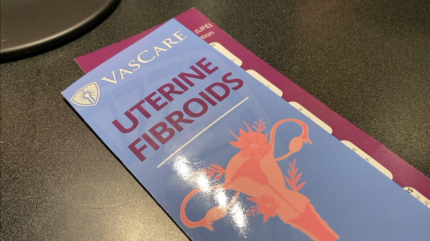 Uterine fibroid embolization helping women in the Coastal Bend - Vimarsana News