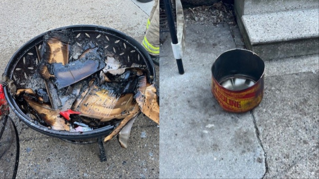 Man burned after pouring gas on a fire