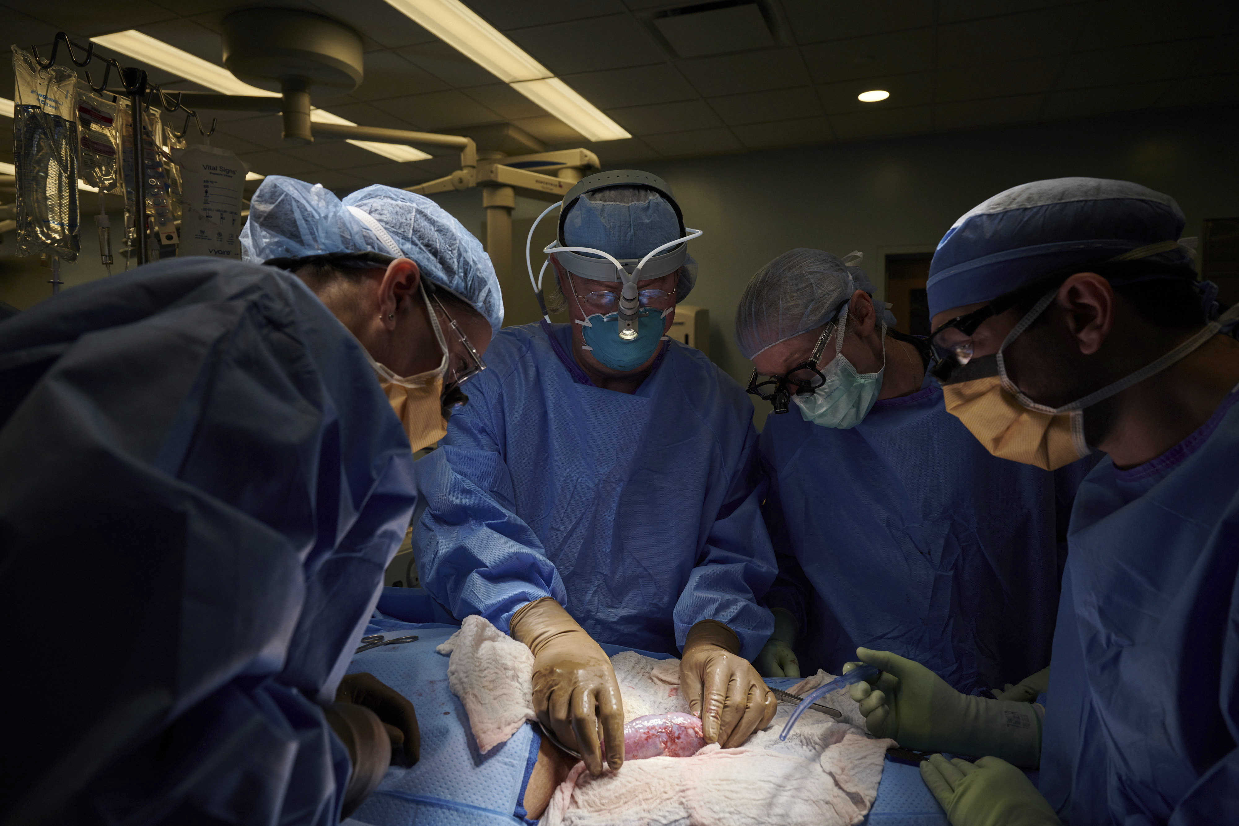 Animal To Human Organs