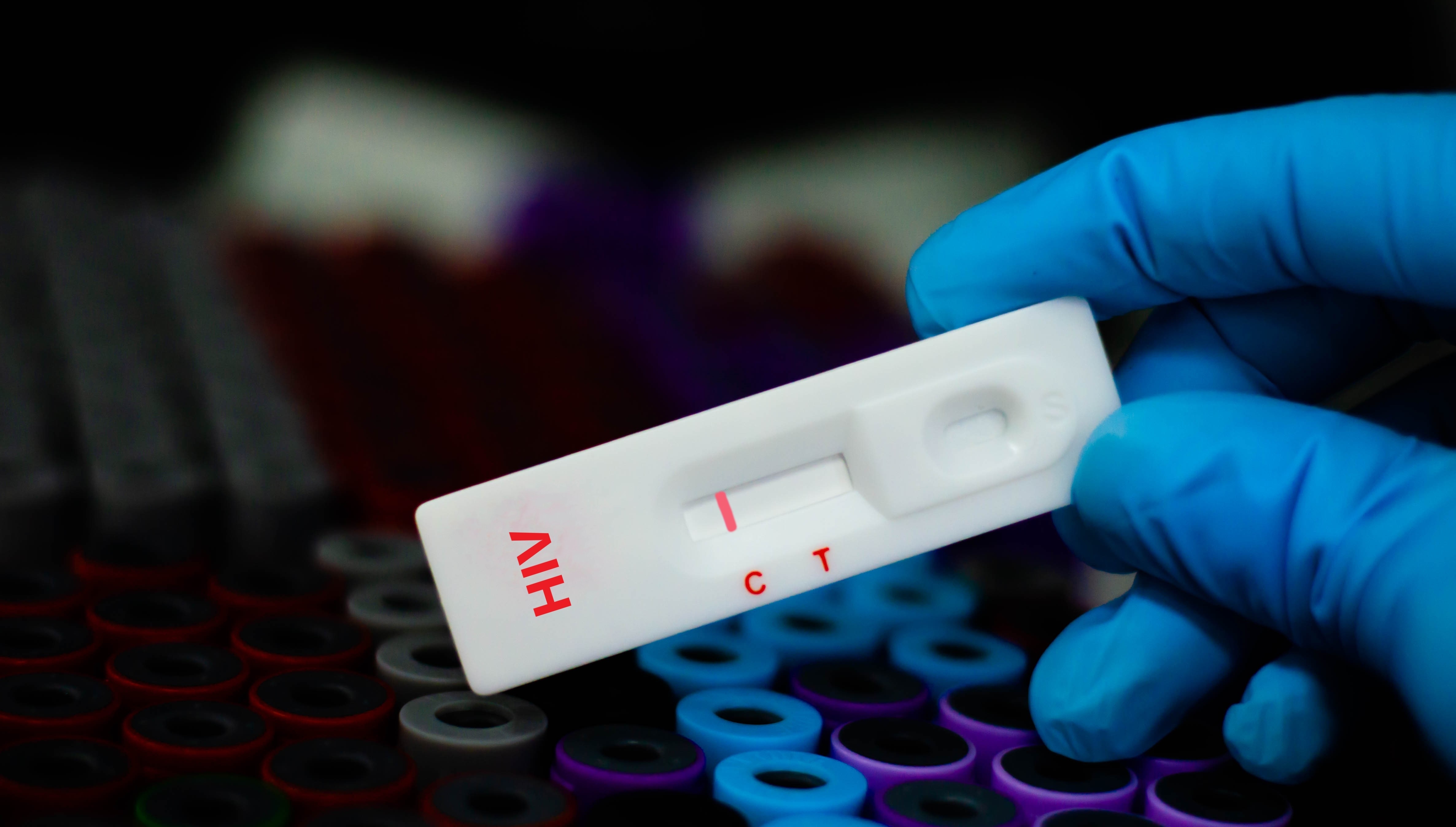 An HIV test