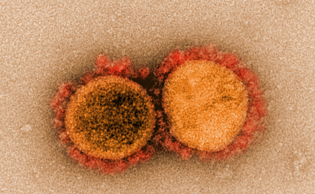 Coronavirus particles