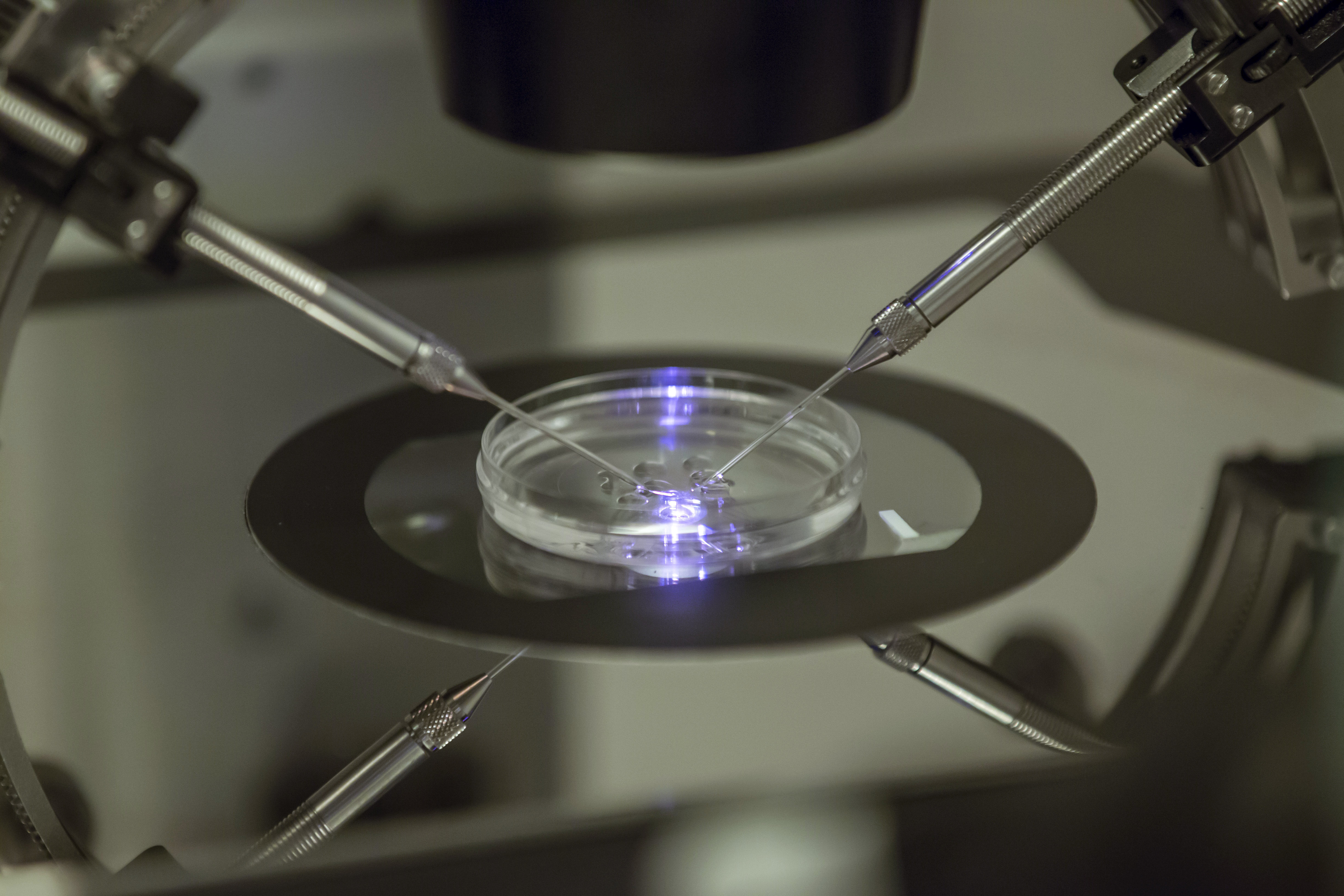 In vitro fertilization