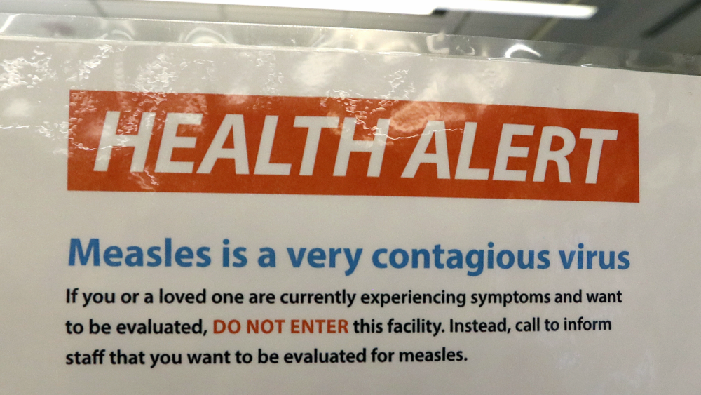 Measles health alert