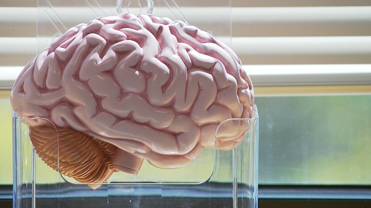 Brain.jpg