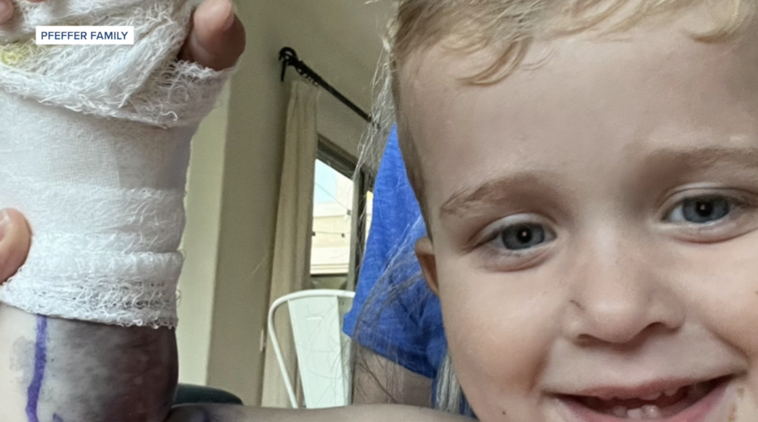 Carmel Valley toddler survives rattlesnake bite