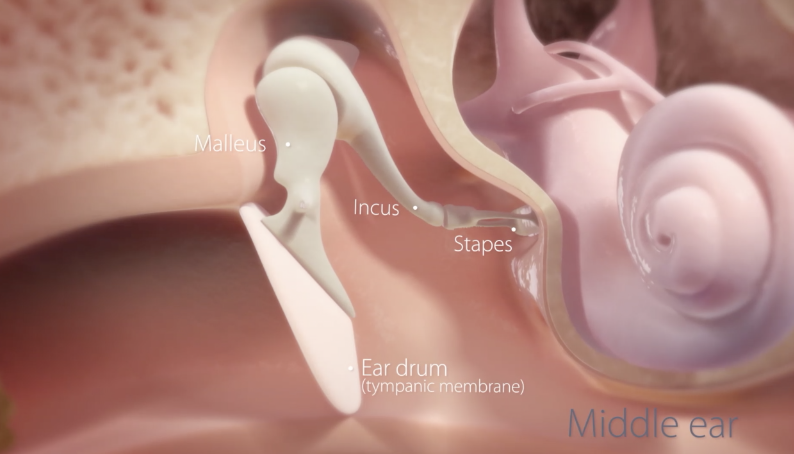 West Michigan doctor using first-of-its-kind device for ear infections 