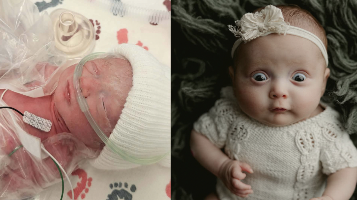Baby Ophelia then and now